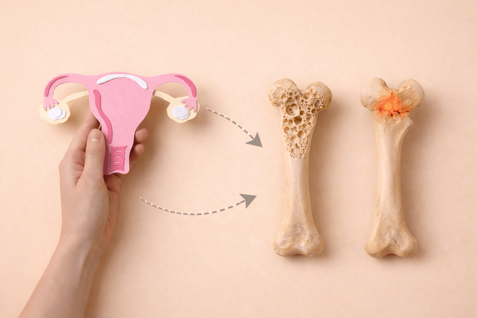 Understanding the Connection Between Menopause and Bone Loss